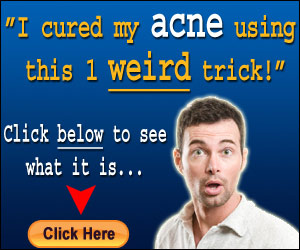acne no more